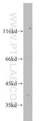 Forkhead Box H1 antibody, 20268-1-AP, Proteintech Group, Western Blot image 