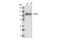 Phosphatidylinositol-4,5-Bisphosphate 3-Kinase Catalytic Subunit Beta antibody, 3011P, Cell Signaling Technology, Western Blot image 