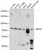 Bardet-Biedl Syndrome 10 antibody, GTX66542, GeneTex, Western Blot image 