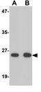 Zinc Finger Protein 346 antibody, GTX31814, GeneTex, Western Blot image 