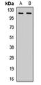 Opioid Growth Factor Receptor antibody, LS-C668716, Lifespan Biosciences, Western Blot image 