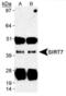 Sirtuin 7 antibody, PA1-46469, Invitrogen Antibodies, Immunoprecipitation image 