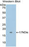 Uromodulin antibody, abx100691, Abbexa, Enzyme Linked Immunosorbent Assay image 