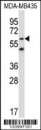 Zinc Finger Protein 479 antibody, 57-330, ProSci, Western Blot image 