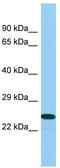 B9 Domain Containing 1 antibody, TA331939, Origene, Western Blot image 