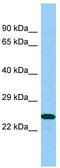 B9 Domain Containing 1 antibody, TA331939, Origene, Western Blot image 