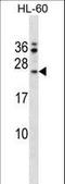 Fas apoptotic inhibitory molecule 1 antibody, LS-C165921, Lifespan Biosciences, Western Blot image 