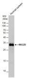 Killer Cell Lectin Like Receptor K1 antibody, GTX104761, GeneTex, Western Blot image 