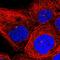 Inositol Polyphosphate-4-Phosphatase Type II B antibody, HPA037682, Atlas Antibodies, Immunofluorescence image 