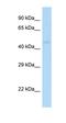 Gamma-Aminobutyric Acid Type A Receptor Pi Subunit antibody, orb324595, Biorbyt, Western Blot image 