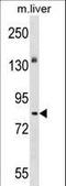 Probable protein kinase-like protein SgK071 homolog antibody, LS-C158255, Lifespan Biosciences, Western Blot image 