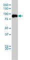 Tousled Like Kinase 2 antibody, H00011011-M01, Novus Biologicals, Western Blot image 