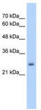 Jac antibody, TA344117, Origene, Western Blot image 