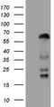 Zinc Finger Protein 35 antibody, M13171-1, Boster Biological Technology, Western Blot image 