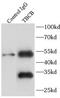Tubulin Folding Cofactor B antibody, FNab08517, FineTest, Immunoprecipitation image 