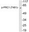 Protein Regulator Of Cytokinesis 1 antibody, LS-C291521, Lifespan Biosciences, Western Blot image 