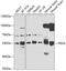 Hexosaminidase Subunit Alpha antibody, GTX33239, GeneTex, Western Blot image 