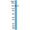 Complement C3d Receptor 2 antibody, M01632-1, Boster Biological Technology, Western Blot image 