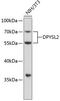 Dihydropyrimidinase Like 2 antibody, 13-235, ProSci, Western Blot image 