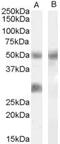 Insulin Like Growth Factor Binding Protein 3 antibody, PA5-18791, Invitrogen Antibodies, Western Blot image 