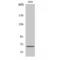 Mitochondrially Encoded NADH:Ubiquinone Oxidoreductase Core Subunit 5 antibody, LS-C384776, Lifespan Biosciences, Western Blot image 