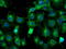 Tubulin Alpha Like 3 antibody, LS-C173510, Lifespan Biosciences, Immunofluorescence image 
