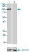 Aryl Hydrocarbon Receptor antibody, H00000196-M02, Novus Biologicals, Western Blot image 