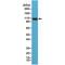 Actinin Alpha 4 antibody, M01975-1, Boster Biological Technology, Western Blot image 