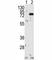 Protein Kinase C Beta antibody, F50027-0.4ML, NSJ Bioreagents, Western Blot image 
