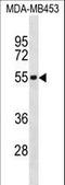 Interleukin 5 Receptor Subunit Alpha antibody, LS-C159920, Lifespan Biosciences, Western Blot image 