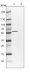 Zinc Finger DHHC-Type Containing 6 antibody, PA5-53152, Invitrogen Antibodies, Western Blot image 