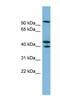 Exocyst Complex Component 5 antibody, NBP1-57629, Novus Biologicals, Western Blot image 