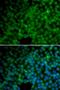 Gamma-Glutamyl Hydrolase antibody, LS-C346086, Lifespan Biosciences, Immunofluorescence image 