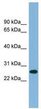 Serine And Arginine Rich Splicing Factor 12 antibody, TA343973, Origene, Western Blot image 