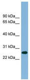 Serine And Arginine Rich Splicing Factor 12 antibody, TA343973, Origene, Western Blot image 