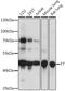 Coagulation Factor VII antibody, 16-394, ProSci, Western Blot image 