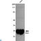 Thiol:disulfide interchange protein DsbA antibody, LS-C812946, Lifespan Biosciences, Western Blot image 