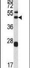 Actin Related Protein 2/3 Complex Subunit 1A antibody, PA5-13448, Invitrogen Antibodies, Western Blot image 