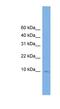 small nuclear ribonucleoprotein D2 pseudogene 2 antibody, NBP1-70708, Novus Biologicals, Western Blot image 