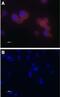 Transient Receptor Potential Cation Channel Subfamily V Member 5 antibody, PA5-77320, Invitrogen Antibodies, Immunocytochemistry image 