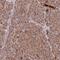 NSE1 Homolog, SMC5-SMC6 Complex Component antibody, PA5-59625, Invitrogen Antibodies, Immunohistochemistry frozen image 