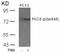 Protein Kinase C Delta antibody, NB100-82141, Novus Biologicals, Western Blot image 