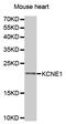 Potassium Voltage-Gated Channel Subfamily E Regulatory Subunit 1 antibody, MBS125292, MyBioSource, Western Blot image 