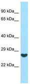 Fibroblast Growth Factor 16 antibody, TA338201, Origene, Western Blot image 