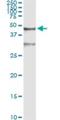 Serpin Family B Member 3 antibody, H00006317-M01, Novus Biologicals, Immunoprecipitation image 