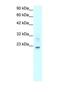 Claudin 9 antibody, PA1-24421, Invitrogen Antibodies, Western Blot image 