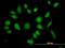 Tetratricopeptide Repeat Domain 1 antibody, H00007265-B01P, Novus Biologicals, Immunofluorescence image 