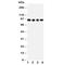 ADAM Metallopeptidase Domain 17 antibody, R30942, NSJ Bioreagents, Western Blot image 