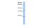 Fucosyltransferase 9 antibody, A06862, Boster Biological Technology, Western Blot image 