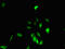 EPH Receptor B6 antibody, CSB-PA007733LA01HU, Cusabio, Immunofluorescence image 